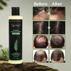 Organic Rosemary Hair Growth Shampoo (Buy 1 Get 1 FREE)