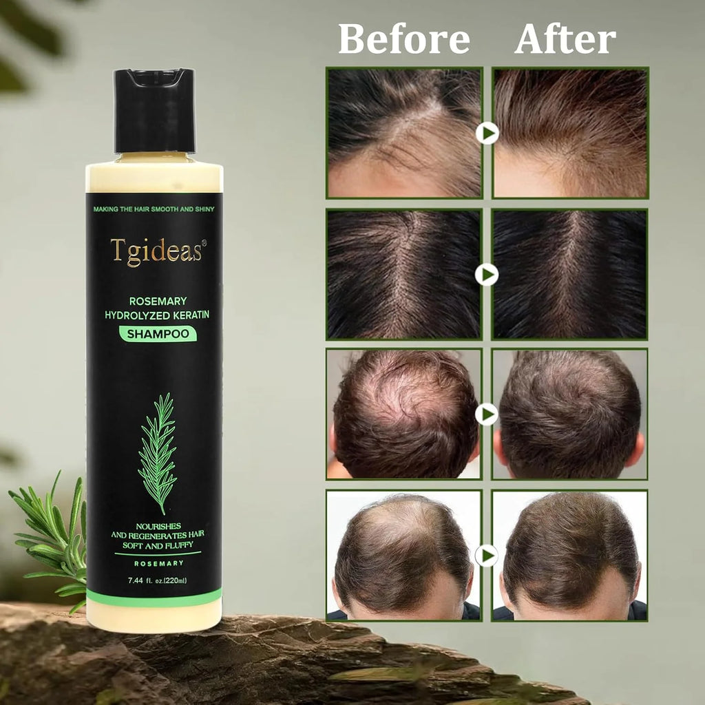 Rosemary Hydrolyzed Keratin Shampoo ( BUY 1 GET 1 FREE )