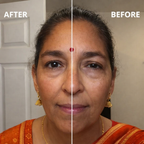 Lymphatic Contour Face Brush - Facial Massager